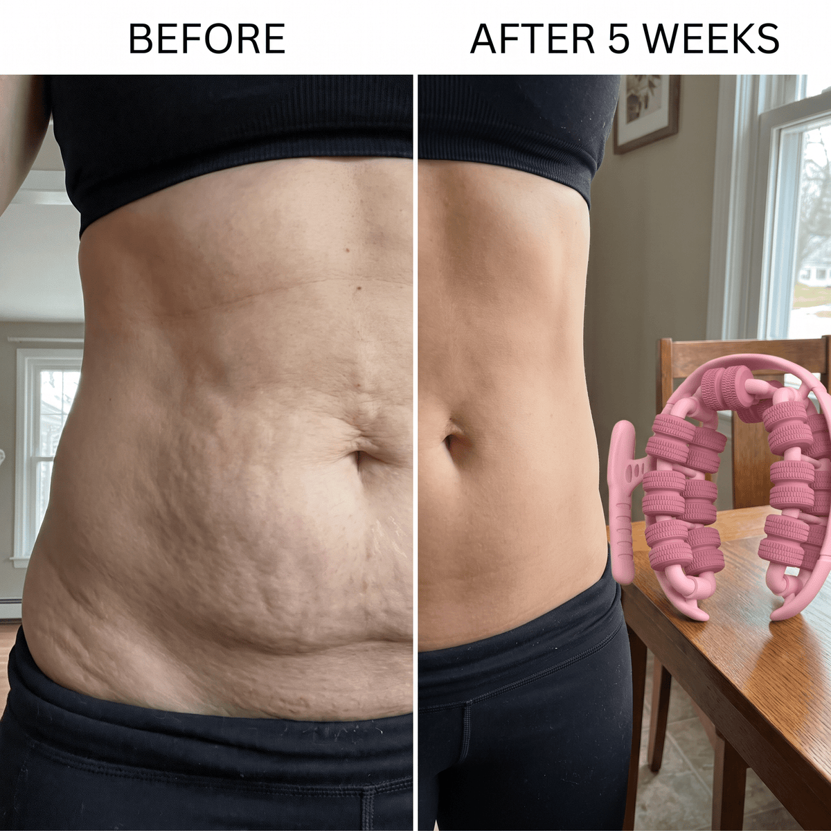 Bodevia Anti-Cellulite Body Roller - Bodevia