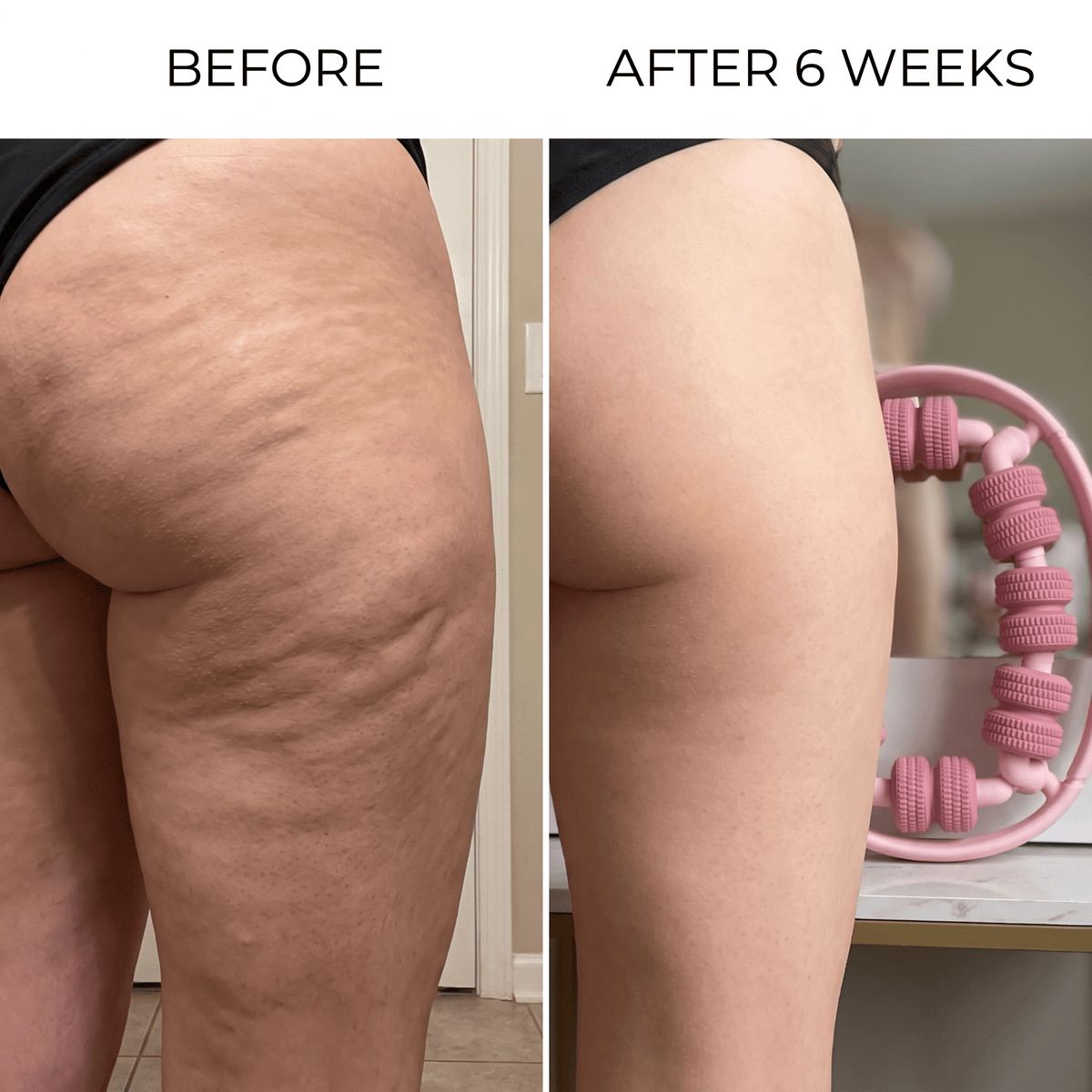 Bodevia Anti-Cellulite Body Roller - Bodevia